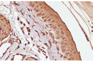 Immunohistochemistry of paraffin-embedded Rat skin using Phospho-β-catenin(S33/S37/T41) Polyclonal Antibody at dilution of 1:100 (40x lens).