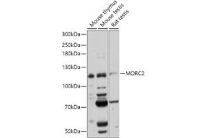 Western blot analysis of extracts of various cell lines, using MORC2 antibody (ABIN7268683) at 1:1000 dilution. (MORC2 anticorps  (AA 60-250))