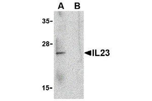 IL23 anticorps  (C-Term)