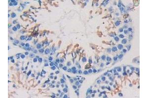 Detection of NEXN in Mouse Testis Tissue using Polyclonal Antibody to Nexilin (NEXN)