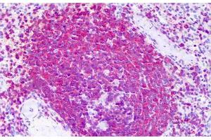 Anti-RICTOR antibody IHC staining of human spleen. (RICTOR anticorps  (AA 1-99))