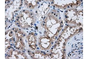 Image no. 2 for anti-V-Akt Murine Thymoma Viral Oncogene Homolog 2 (AKT2) antibody (ABIN1496564) (AKT2 anticorps)