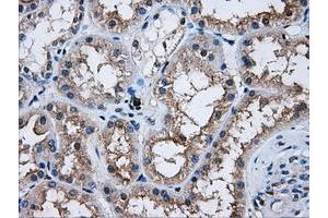 Image no. 2 for anti-V-Akt Murine Thymoma Viral Oncogene Homolog 2 (AKT2) antibody (ABIN1496564)