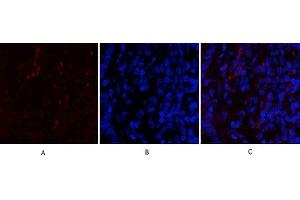 Immunofluorescence analysis of rat lung tissue. (CDK4 anticorps  (N-Term))