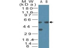 Western blot analysis of VDAC2 in human brain cell lysate in the A) absence and B) presence of immunizing peptide. (VDAC2 anticorps  (AA 120-132))