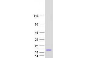 Validation with Western Blot
