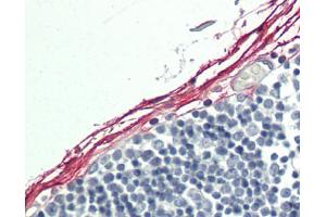 Human Fibroblasts: Formalin-Fixed, Paraffin-Embedded (FFPE). (Indian Hedgehog anticorps  (Biotin))