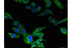 Immunofluorescent analysis of Hela cells using ABIN7146428 at dilution of 1:100 and Alexa Fluor 488-congugated AffiniPure Goat Anti-Rabbit IgG(H+L) (CAMK1 anticorps  (AA 166-265))