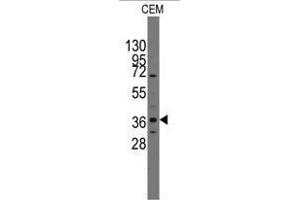 Image no. 1 for anti-Paired-Like Homeodomain 2 (PITX2) (C-Term) antibody (ABIN356913) (PITX2 anticorps  (C-Term))