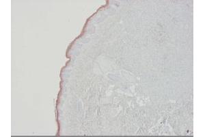 Image no. 2 for anti-Keratin 10 (KRT10) antibody (ABIN959490)