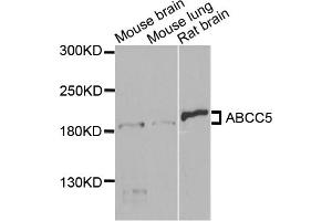 Western blot analysis of extracts of various cell lines, using ABCC5 antibody (ABIN5971551) at 1/1000 dilution. (ABCC5 anticorps)