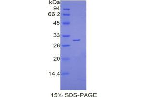 SDS-PAGE analysis of Mouse Lymphocyte Antigen 9 Protein. (LY9 Protéine)