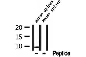 Western blot analysis of extracts from mouse spleen, using NDUFC1 Antibody. (NDUFC1 anticorps  (C-Term))