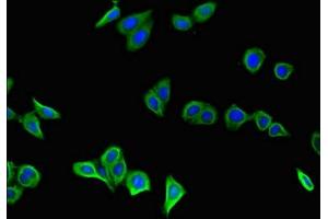 Immunofluorescent analysis of HepG2 cells using ABIN7154085 at dilution of 1:100 and Alexa Fluor 488-congugated AffiniPure Goat Anti-Rabbit IgG(H+L)
