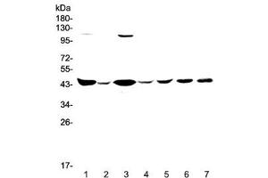 Western blot testing of human 1) HeLa, 2) placenta, 3) COLO-320, 4) SW620, 5) MDA-MB-231, 6) rat brain and 7) mouse brain lysate with CKB antibody at 0. (CKB anticorps)