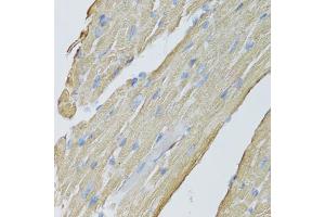 Immunohistochemistry of paraffin-embedded mouse heart using CKMT2 antibody (ABIN5975698) at dilution of 1/100 (40x lens). (CKMT2 anticorps)