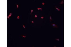 ABIN6267057 staining HT-1080 cells by IF/ICC. (Cyclin D1 anticorps  (pThr286))