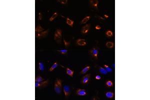 Immunofluorescence analysis of U-2 OS cells using LRRFIP2 antibody (ABIN7268214) at dilution of 1:100. (LRRFIP2 anticorps  (AA 150-340))