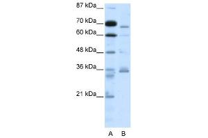 PCSK6 antibody (20R-1074) used at 1. (PCSK6 anticorps  (N-Term))