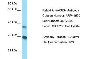 WB Suggested Anti-VSIG4 AntibodyTitration: 1. (VSIG4 anticorps  (N-Term))