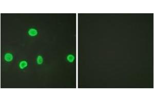 Immunofluorescence analysis of HeLa cells, using Histone H3 (Acetyl-Lys18) Antibody. (Histone 3 anticorps  (H3K18ac))