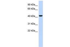 Image no. 1 for anti-Sphingomyelin Synthase 2 (SGMS2) (AA 71-120) antibody (ABIN6741219) (Sphingomyelin Synthase 2 anticorps  (AA 71-120))