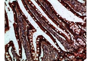 Immunohistochemical analysis of paraffin-embedded human-small-intestine, antibody was diluted at 1:200 (FABP2 anticorps  (AA 90-132))