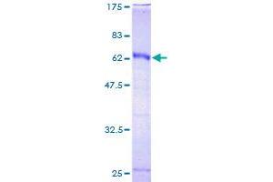 Image no. 1 for Homeobox C9 (HOXC9) (AA 1-260) protein (GST tag) (ABIN1306995)