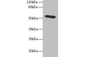 Western blot All lanes: Hpx antibody at 4. (Hemopexin anticorps  (AA 24-460))