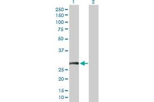 Western Blot analysis of CD8B expression in transfected 293T cell line by CD8B MaxPab polyclonal antibody. (CD8B anticorps  (AA 1-243))