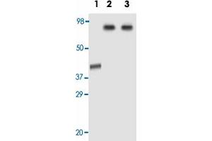 Western blot analysis using AOF2 monoclonal antibody, clone 1B2E5  against truncated AOF2 recombinant protein (Lane 1), HeLa (Lane 2) and Jurkat (Lane 3) cell lysate. (LSD1 anticorps)