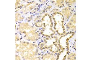 Immunohistochemistry of paraffin-embedded human kidney using S100A11 antibody.