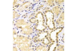 Immunohistochemistry of paraffin-embedded human kidney using S100A11 antibody. (S100A11 anticorps  (AA 1-105))