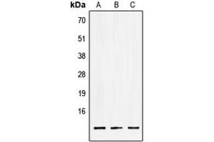 Western blot analysis of LSM2 expression in HEK293T (A), NIH3T3 (B), PC12 (C) whole cell lysates. (LSM2 anticorps  (Center))