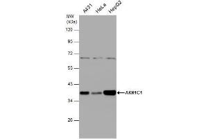 WB Image Various whole cell extracts (30 μg) were separated by 10% SDS-PAGE, and the membrane was blotted with AKR1C1 antibody , diluted at 1:1000. (AKR1C1 anticorps)
