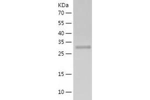 Western Blotting (WB) image for Aryl Hydrocarbon Receptor Interacting Protein (AIP) (AA 1-330) protein (His-IF2DI Tag) (ABIN7121901)