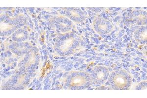 Detection of HBb in Mouse Uterus Tissue using Polyclonal Antibody to Hemoglobin Beta (HBb)
