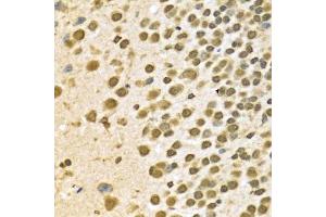 Immunohistochemistry of paraffin-embedded mouse brain using HNRNPA2B1 Antibody. (HNRNPA2B1 anticorps  (AA 1-180))