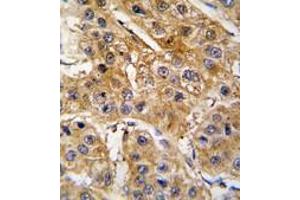 Image no. 2 for anti-Angiotensinogen (serpin Peptidase Inhibitor, Clade A, Member 8) (AGT) (N-Term) antibody (ABIN360211) (AGT anticorps  (N-Term))