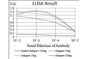 Black line: Control Antigen (100 ng), Purple line: Antigen(10 ng), Blue line: Antigen (50 ng), Red line: Antigen (100 ng),