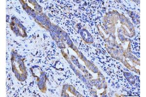 IHC analysis of BCKDK using anti-BCKDK antibody (ABIN7601470). (BCKDK anticorps  (AA 36-316))