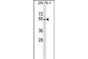 Western blot analysis in ZR-75-1 cell line lysates (35ug/lane). (Phospholipase D4 anticorps  (N-Term))