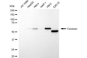 Western blotting analysis using catalase antibody (ABIN7797919).