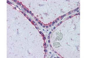 Immunohistochemistry with HeLa, Vera, HeLa transfected with mouse construct tissue (KIF20A anticorps  (Middle Region))