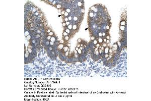 Human Intestine (TFB2M anticorps  (N-Term))