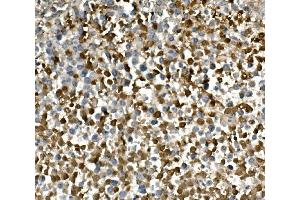 IHC analysis of HGS using anti-HGS antibody (ABIN7601205).