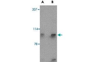 Western blot analysis of SLITRK4 in mouse brain tissue lysate with SLITRK4 polyclonal antibody  at (A) 0.
