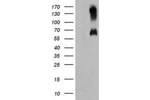 Western Blotting (WB) image for anti-Chromosome 18 Open Reading Frame 8 (C18orf8) antibody (ABIN1497027) (C18orf8 anticorps)
