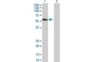 Western Blot analysis of PPP5C expression in transfected 293T cell line by PPP5C MaxPab polyclonal antibody. (PP5 anticorps  (AA 1-499))