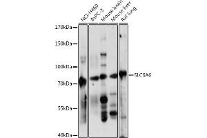 Western blot analysis of extracts of various cell lines, using SLC6 antibody (ABIN7270739) at 1:1000 dilution. (TAUT anticorps  (AA 250-320))
